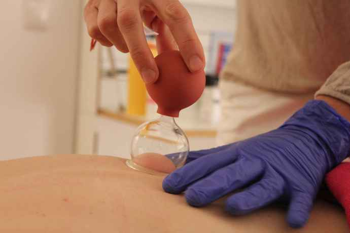 Dry Needling